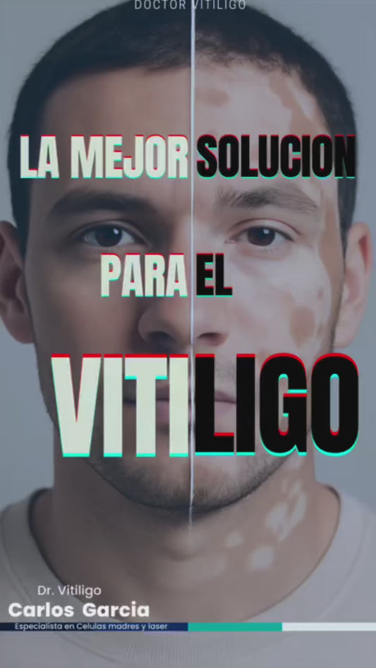 Antied Vit 90% | Regenerador Avanzado de Células Madre para Vitíligo